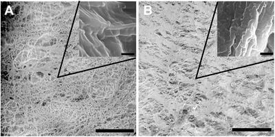 Multiparametric Optical Bioimaging Reveals the Fate of Epoxy Crosslinked Biomeshes in the Mouse Subcutaneous Implantation Model